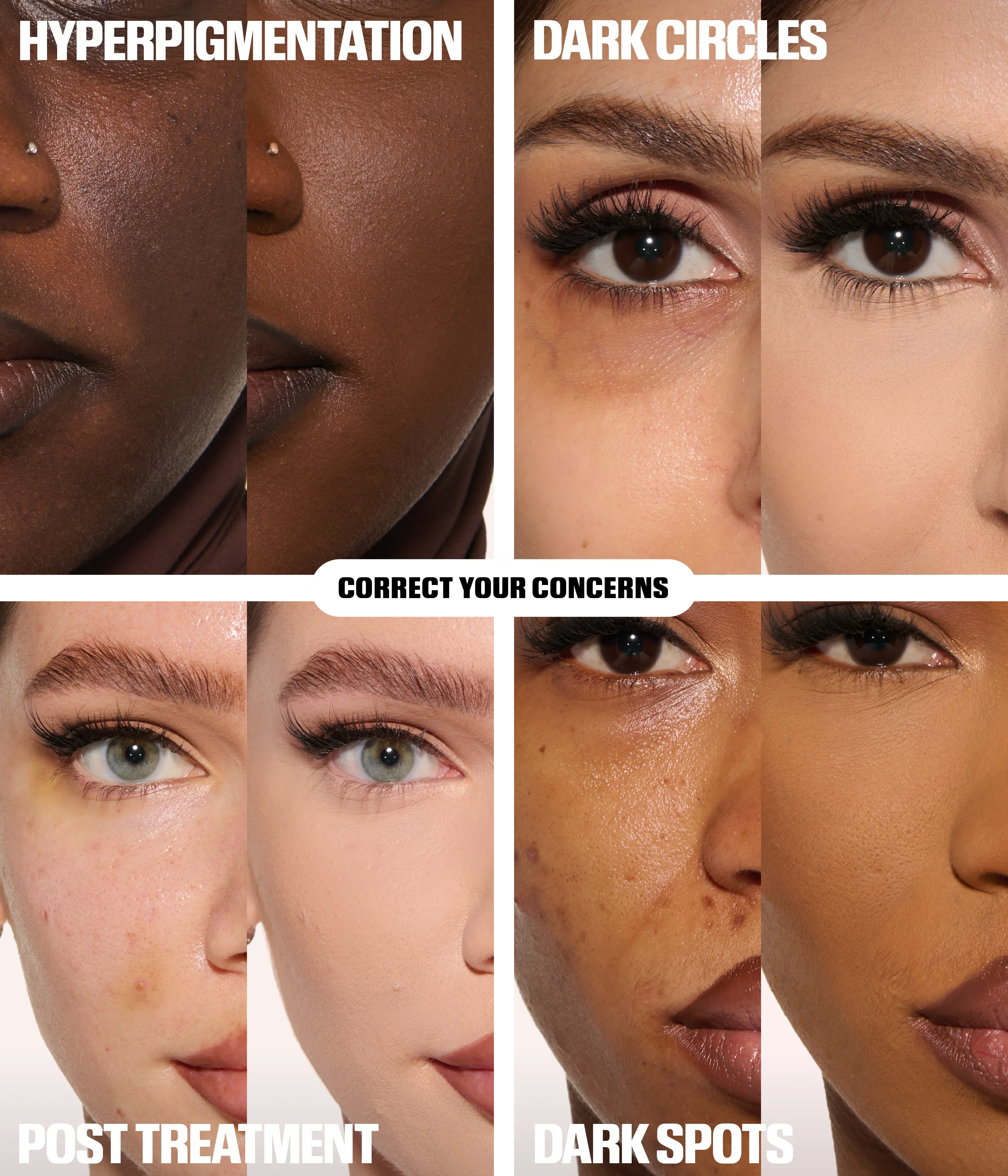 The Undereye Buff Brush Kit